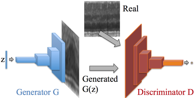 Architecture diagram of the AnoGAN DCGAN: transposed convolutional layers mapping a noise vector to an image, and strided convolutional layers mapping an image to a scalar.